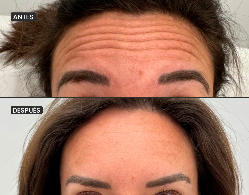 AyD_1024x800_botoxfrente_1