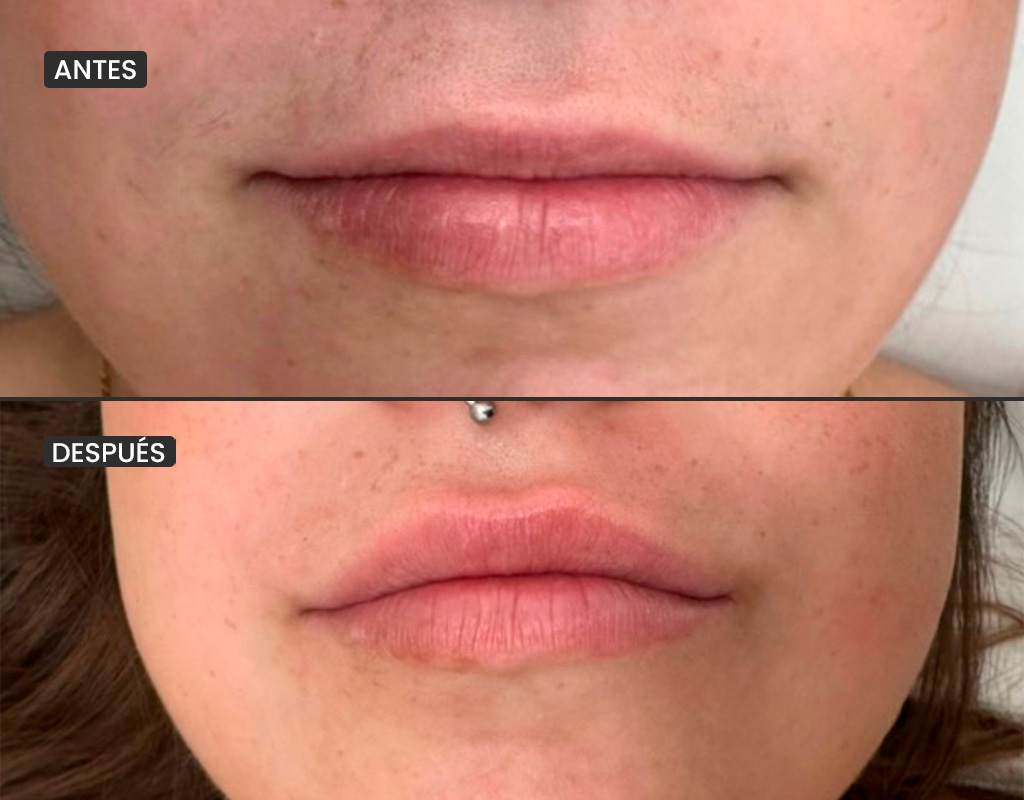 AyD_1024x800_labios1