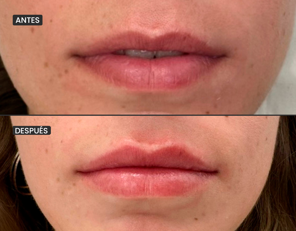 AyD_1024x800_labios2