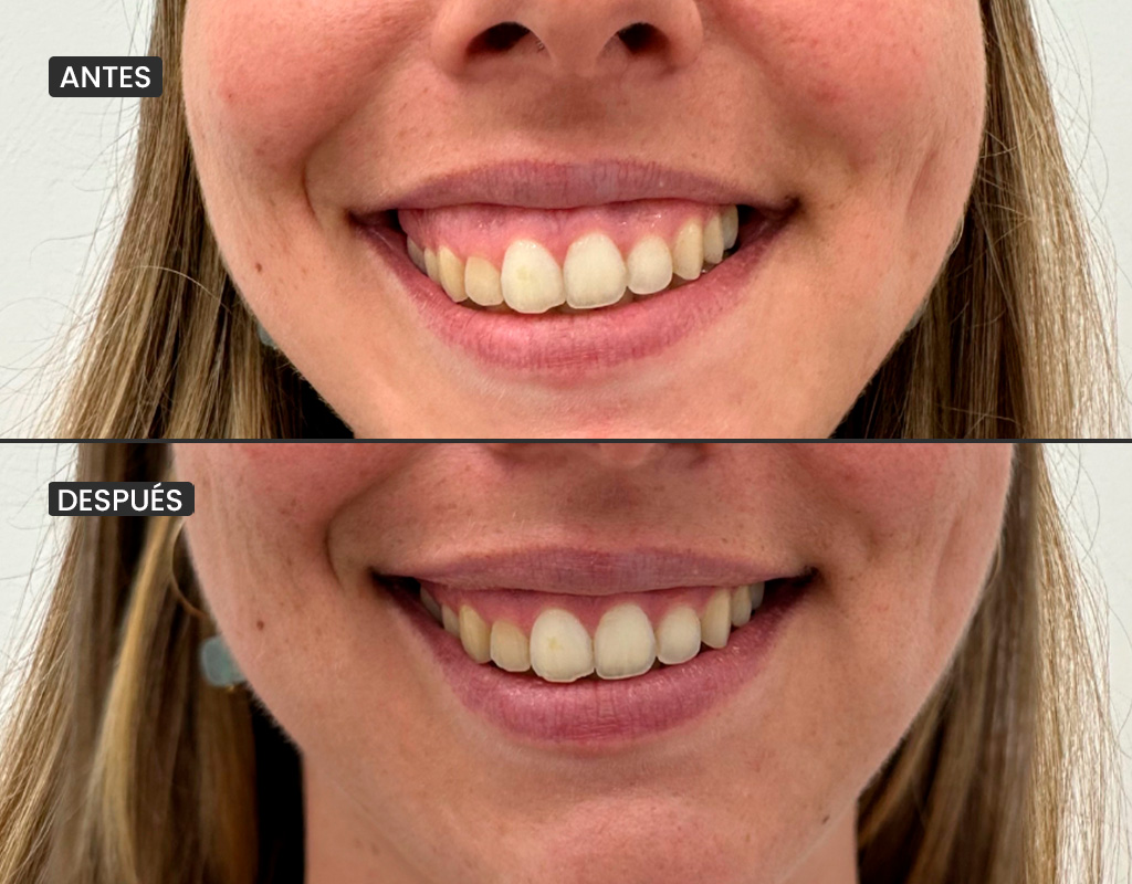 AyD_1024x800_sonrisagingi_1