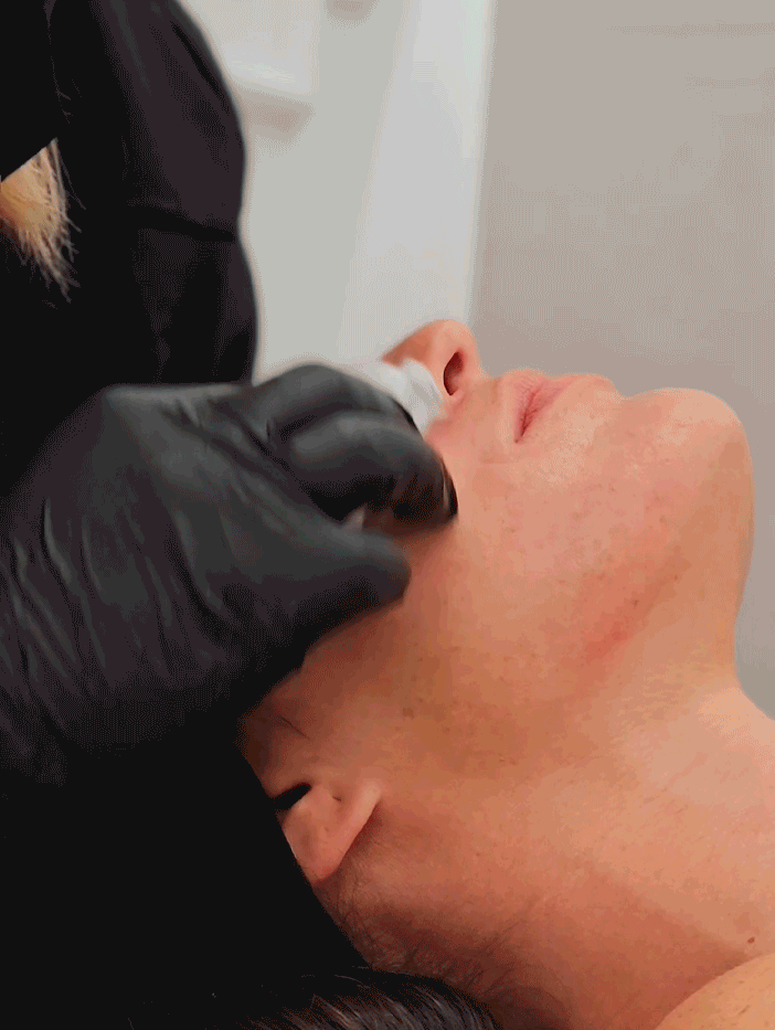 Valoración médica de manchas faciales